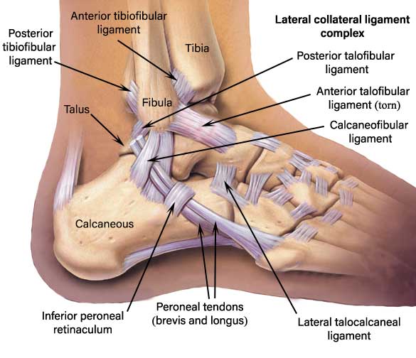 Ankle Sprain - Symptoms, Diagnosis and Treatment - MedFog