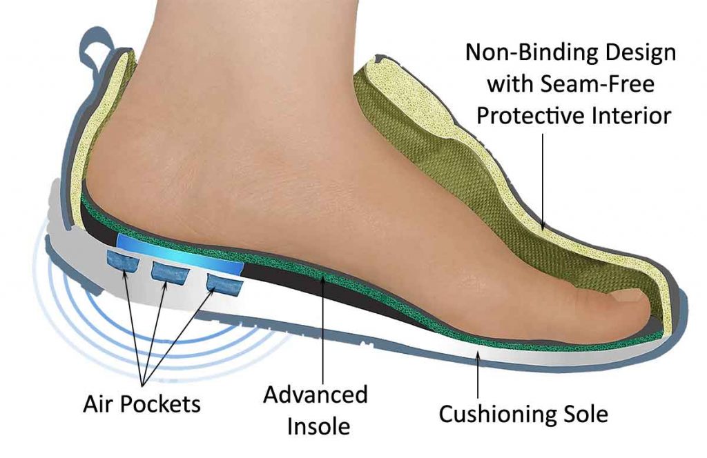 Ulcers - Identification and treatment of different types of Ulcers