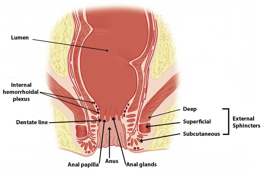 Anal fissure