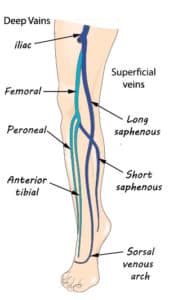 Varicose veins - Symptoms, Causes and Treatments - MedFog